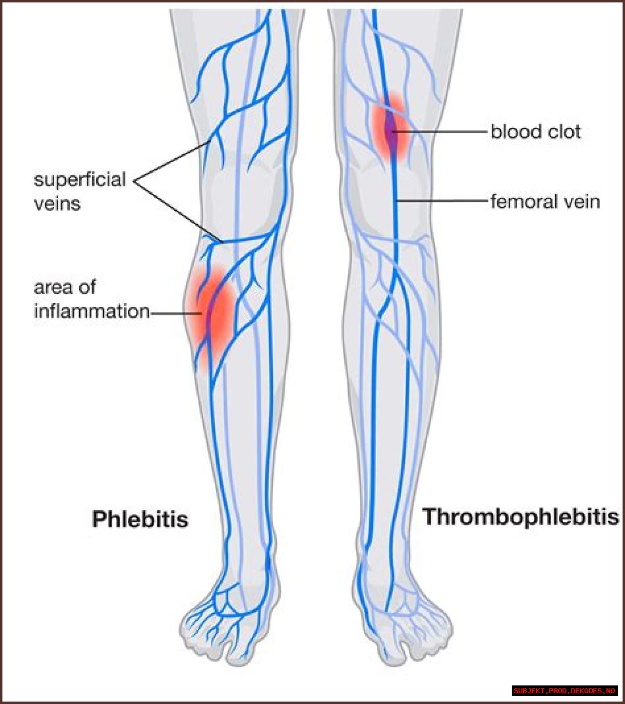 Can you feel blood rushing through your legs?