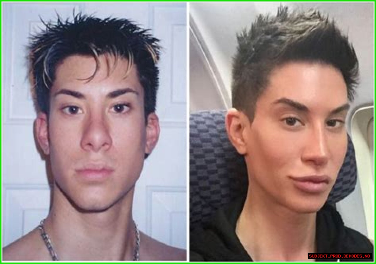 See What 'Human Ken Doll' Justin Jedlica Looked Like Before Plastic Surgery!